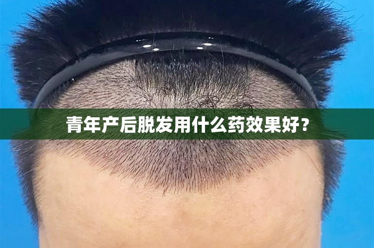 青年产后脱发用什么药效果好？