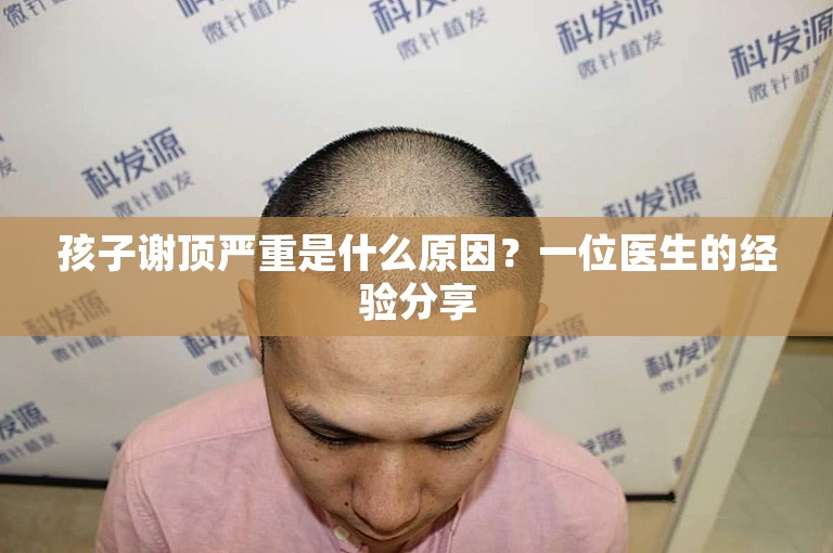 孩子谢顶严重是什么原因？一位医生的经验分享