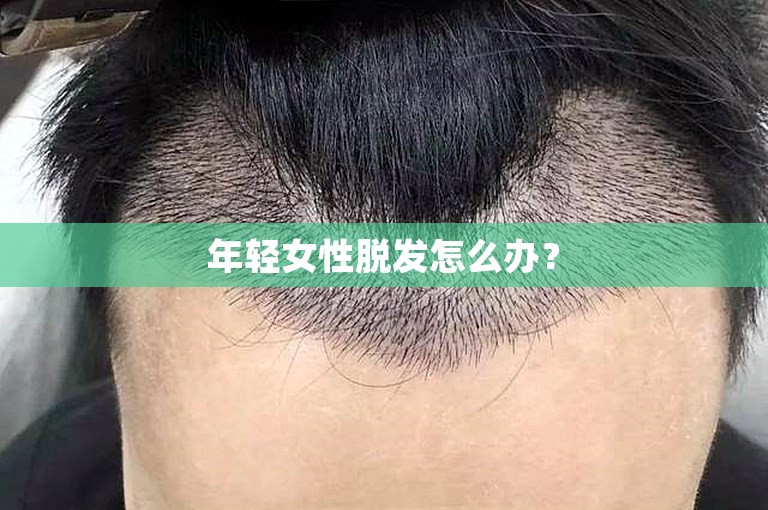 年轻女性脱发怎么办？