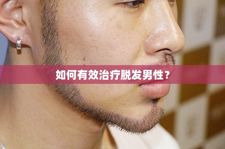 如何有效治疗脱发男性？