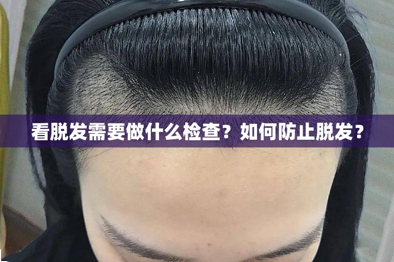 看脱发需要做什么检查？如何防止脱发？