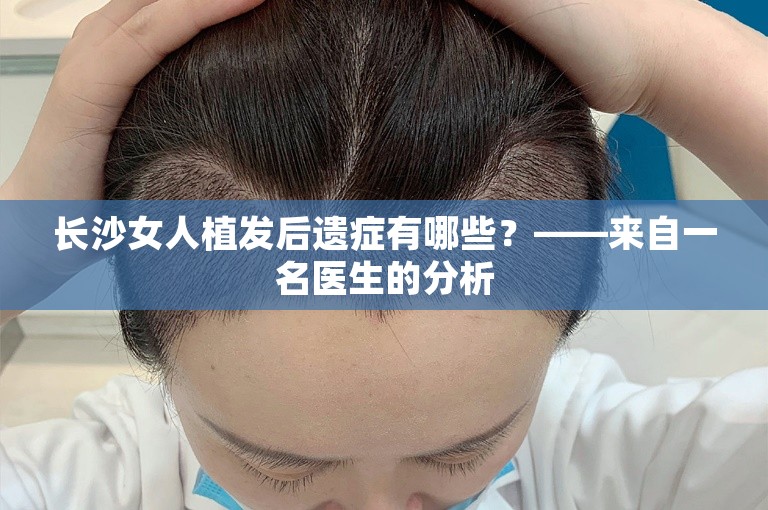 长沙女人植发后遗症有哪些？——来自一名医生的分析