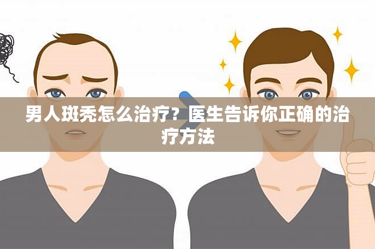 男人斑秃怎么治疗？医生告诉你正确的治疗方法