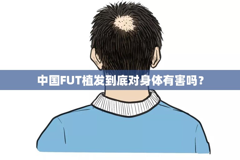 中国FUT植发到底对身体有害吗？