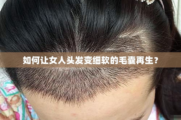 如何让女人头发变细软的毛囊再生？