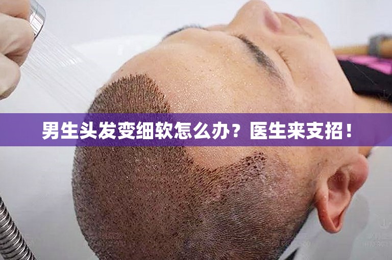 男生头发变细软怎么办？医生来支招！