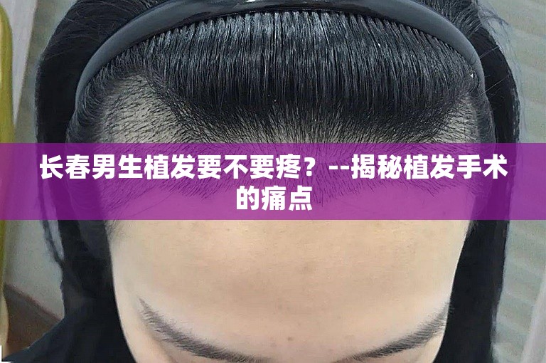 长春男生植发要不要疼？--揭秘植发手术的痛点