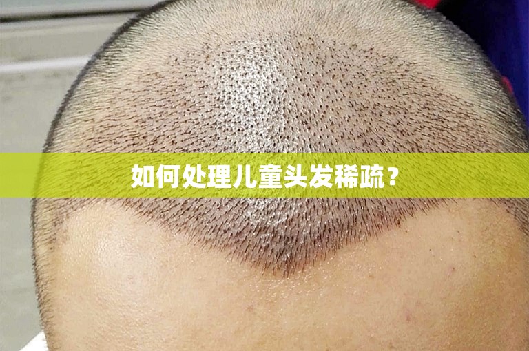 如何处理儿童头发稀疏？