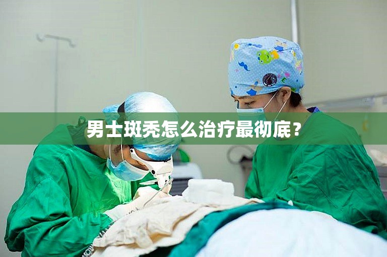 男士斑秃怎么治疗最彻底？