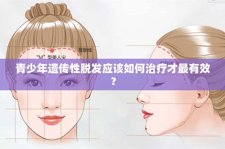 青少年遗传性脱发应该如何治疗才最有效？