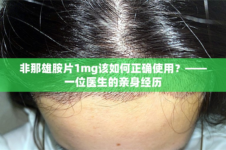 非那雄胺片1mg该如何正确使用？——一位医生的亲身经历