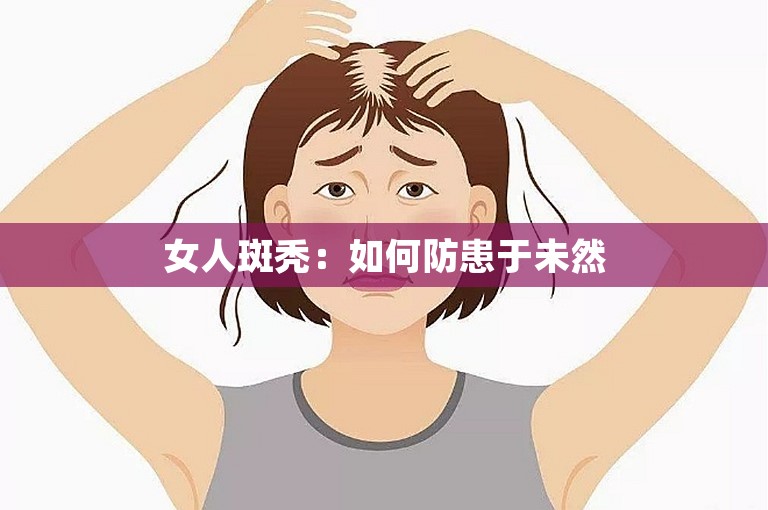 女人斑秃：如何防患于未然