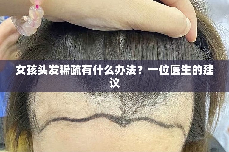 女孩头发稀疏有什么办法？一位医生的建议