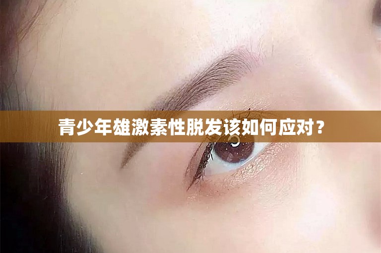 青少年雄激素性脱发该如何应对？