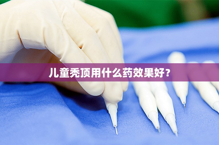 儿童秃顶用什么药效果好？