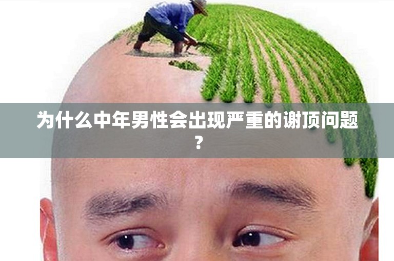 为什么中年男性会出现严重的谢顶问题？