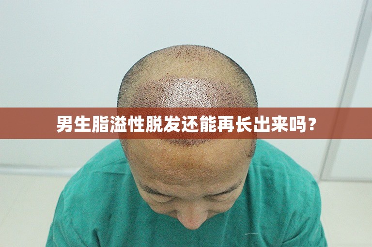 男生脂溢性脱发还能再长出来吗？