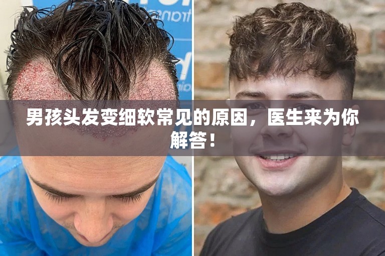 男孩头发变细软常见的原因，医生来为你解答！