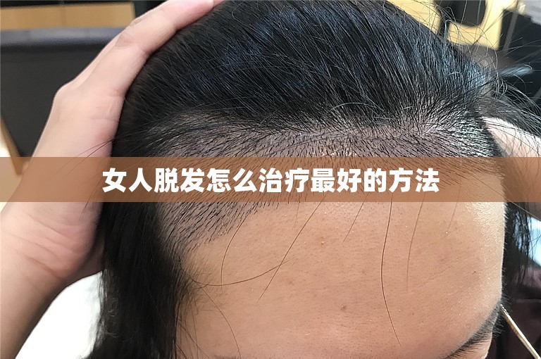 女人脱发怎么治疗最好的方法