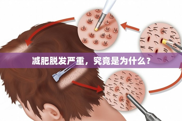 减肥脱发严重，究竟是为什么？