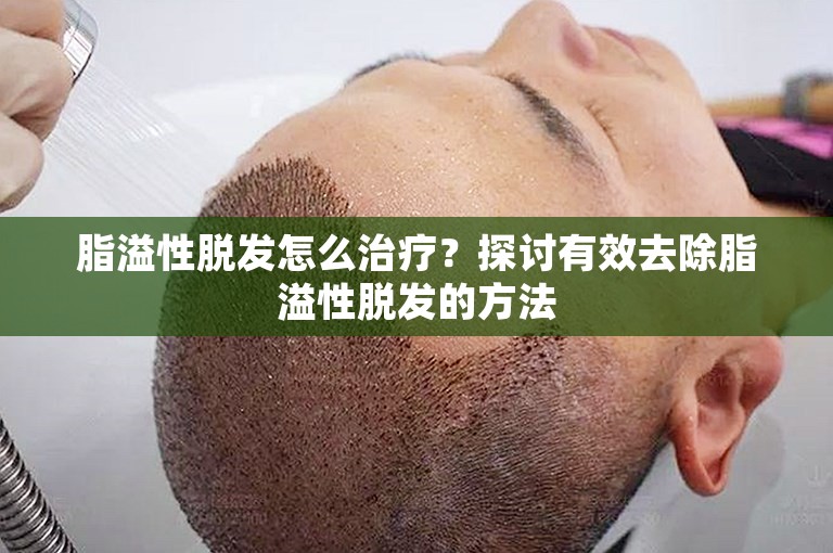 脂溢性脱发怎么治疗？探讨有效去除脂溢性脱发的方法