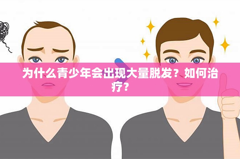 为什么青少年会出现大量脱发？如何治疗？