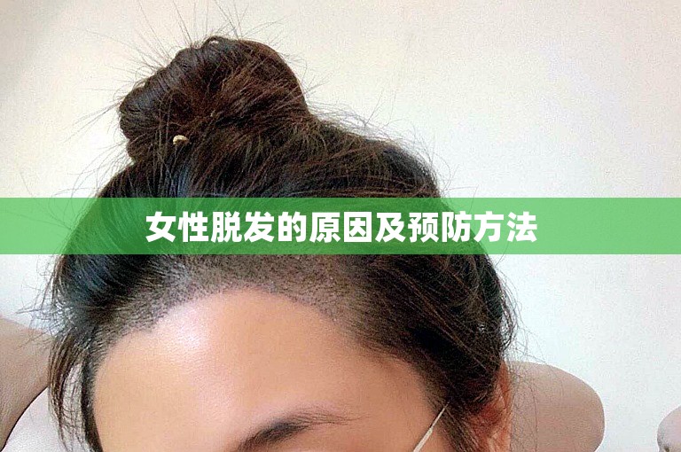 女性脱发的原因及预防方法