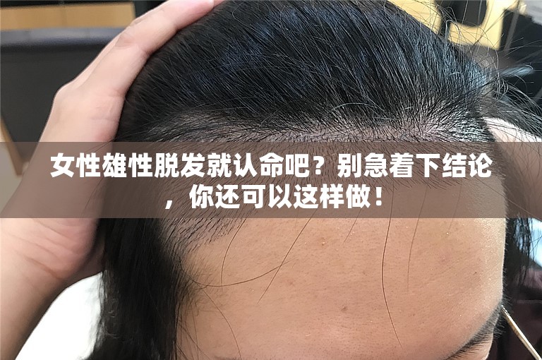 女性雄性脱发就认命吧？别急着下结论，你还可以这样做！