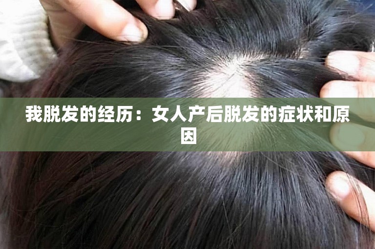 我脱发的经历：女人产后脱发的症状和原因