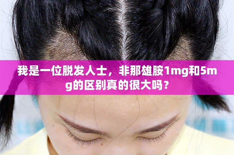 我是一位脱发人士，非那雄胺1mg和5mg的区别真的很大吗？