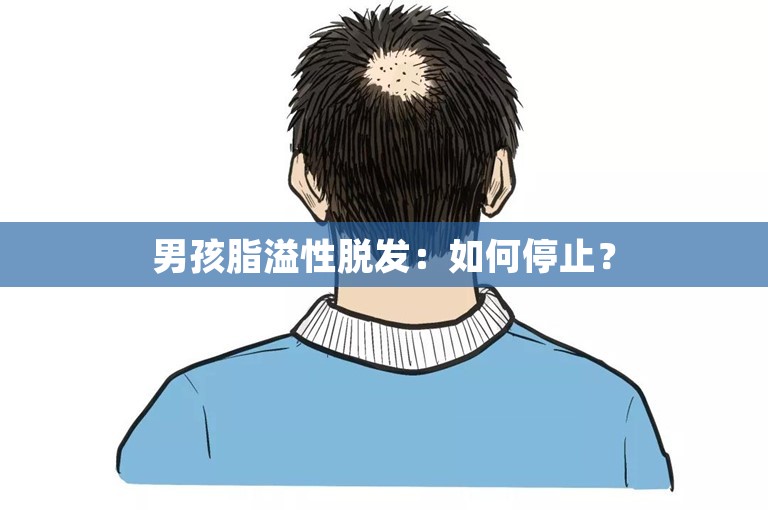 男孩脂溢性脱发：如何停止？