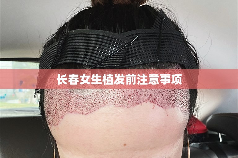 长春女生植发前注意事项