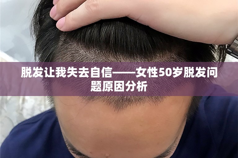 脱发让我失去自信——女性50岁脱发问题原因分析