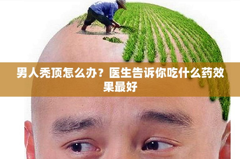 男人秃顶怎么办？医生告诉你吃什么药效果最好