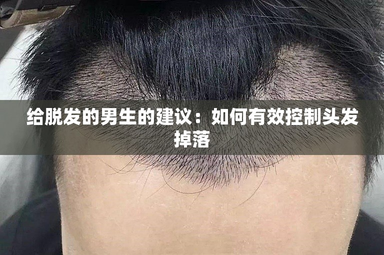 给脱发的男生的建议：如何有效控制头发掉落