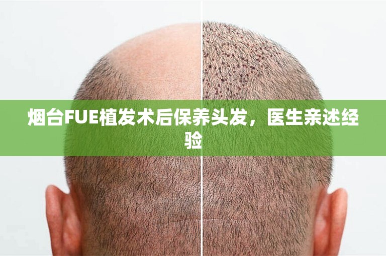 烟台FUE植发术后保养头发，医生亲述经验