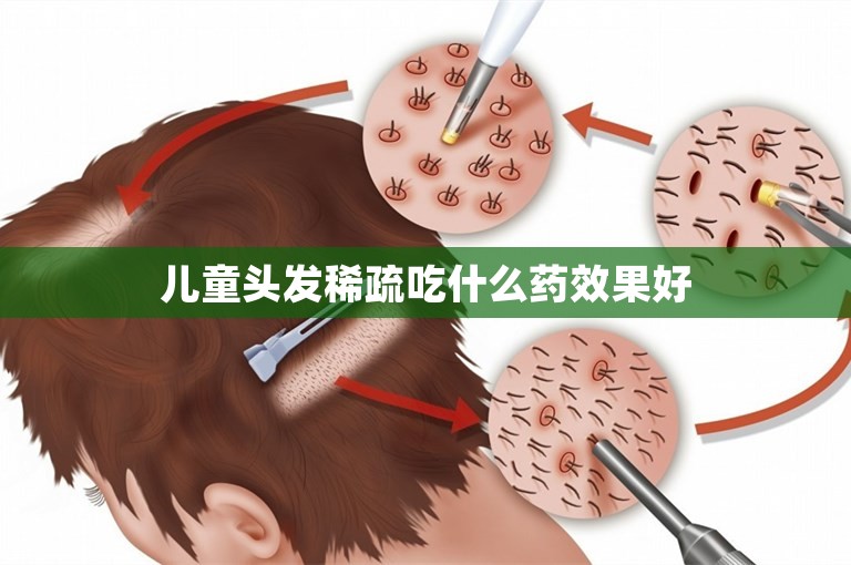 儿童头发稀疏吃什么药效果好