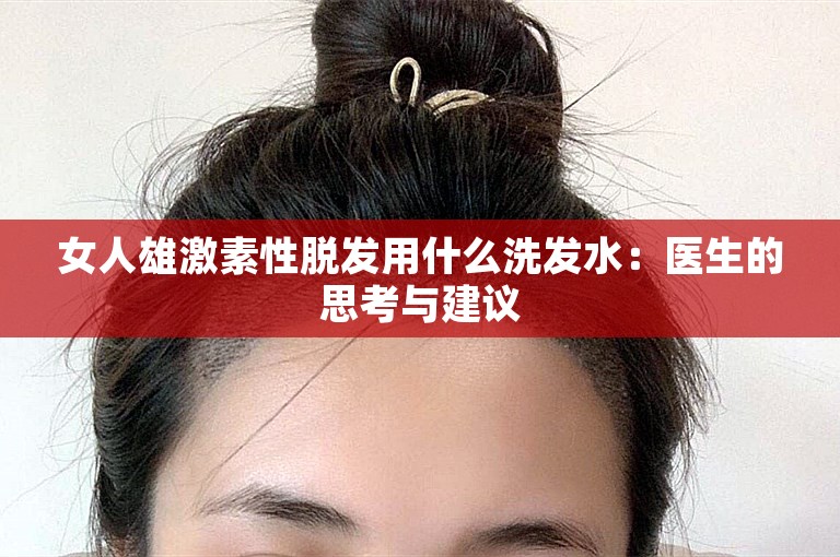 女人雄激素性脱发用什么洗发水：医生的思考与建议