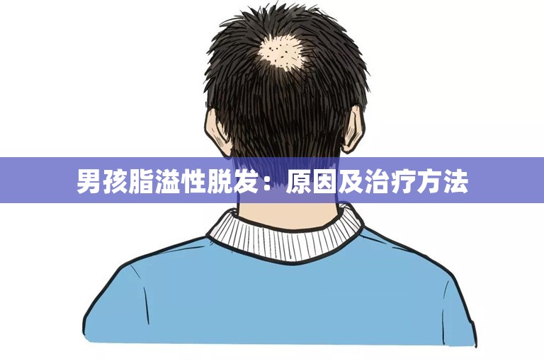 男孩脂溢性脱发：原因及治疗方法