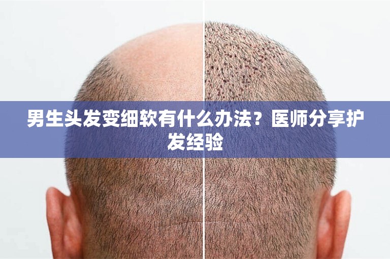 男生头发变细软有什么办法？医师分享护发经验