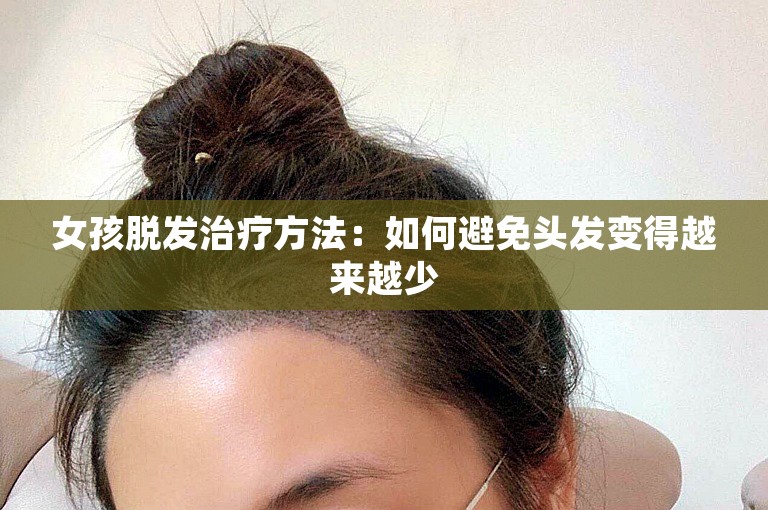 女孩脱发治疗方法：如何避免头发变得越来越少