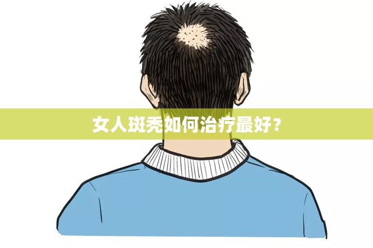 女人斑秃如何治疗最好？