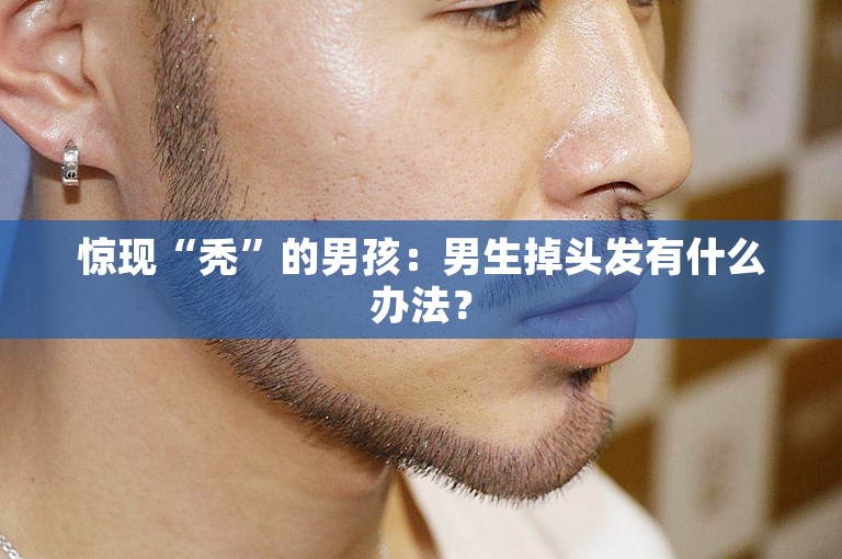 惊现“秃”的男孩：男生掉头发有什么办法？