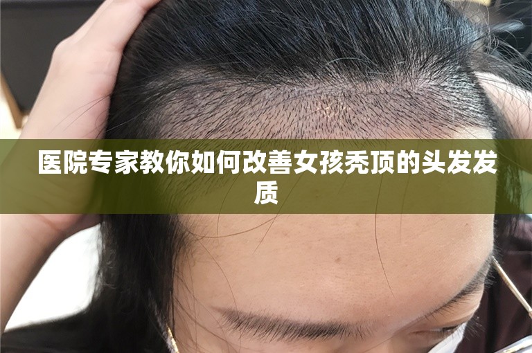 医院专家教你如何改善女孩秃顶的头发发质