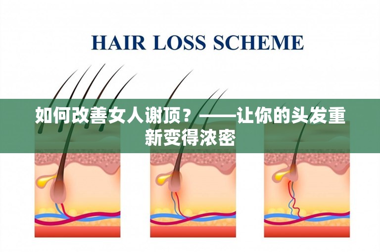 如何改善女人谢顶？——让你的头发重新变得浓密