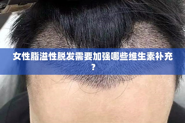 女性脂溢性脱发需要加强哪些维生素补充？