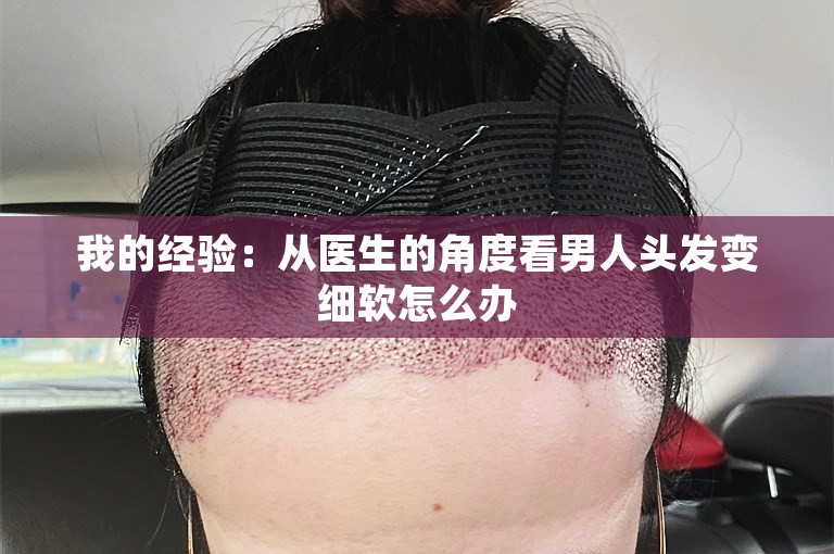 我的经验：从医生的角度看男人头发变细软怎么办