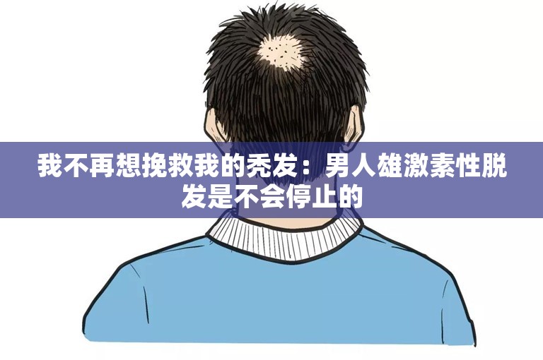 我不再想挽救我的秃发：男人雄激素性脱发是不会停止的