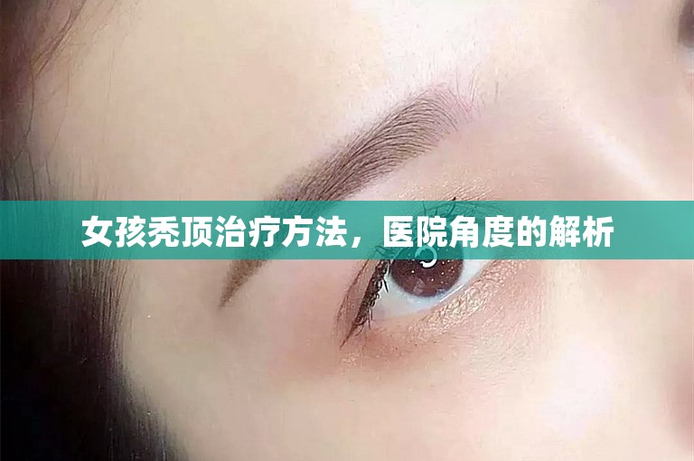 女孩秃顶治疗方法，医院角度的解析