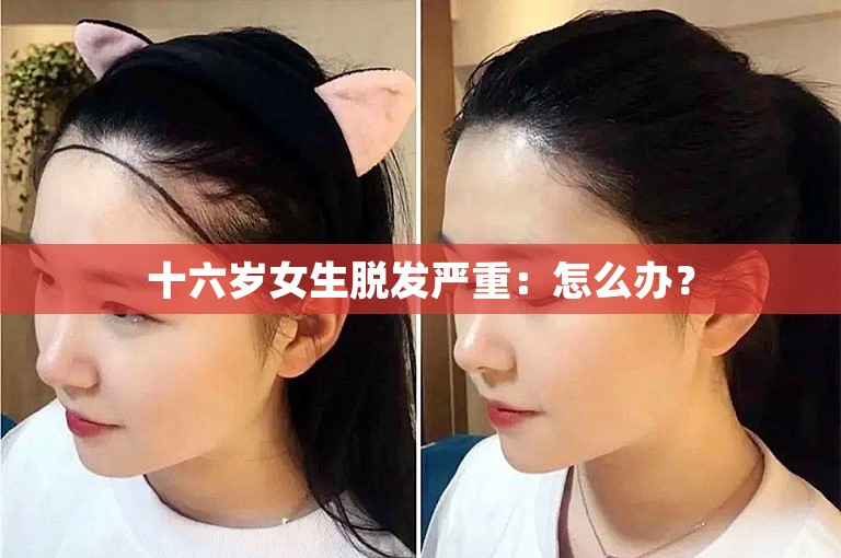 十六岁女生脱发严重：怎么办？